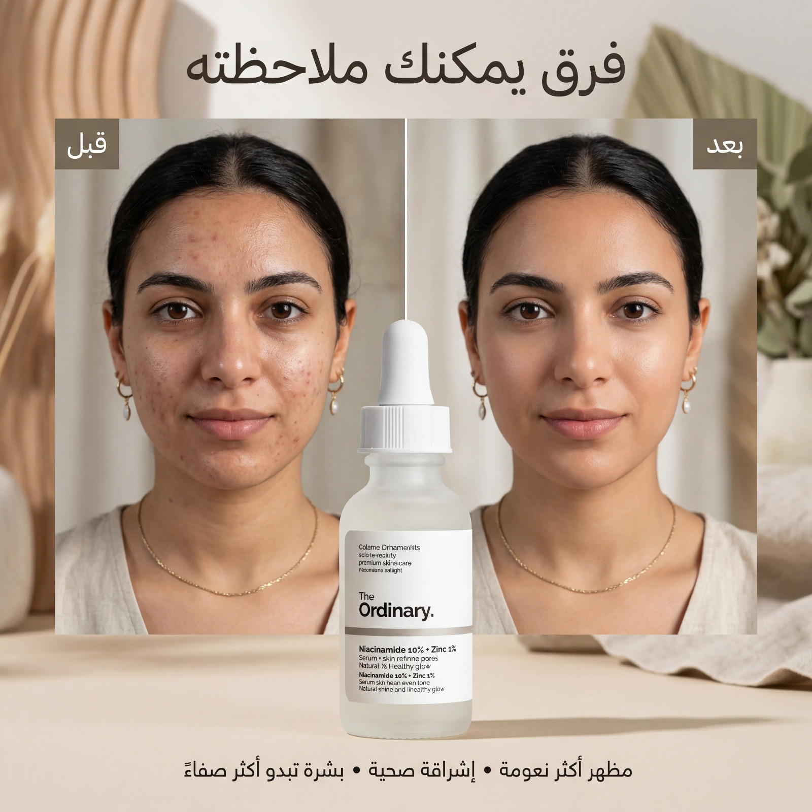 The Ordinary Niacinamide 10% + Zinc 1%